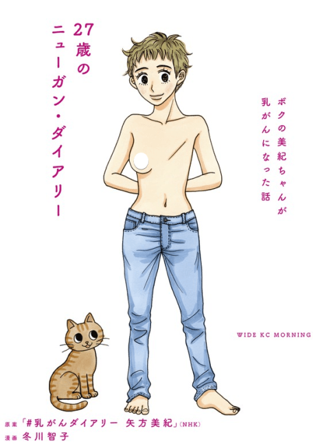 27-sai no Nyuugan Diary: Boku no Michikan ga Nyuugan ni Natta Hanashi cover